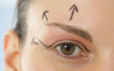 Paupières tombantes ? Essayez le Plexr