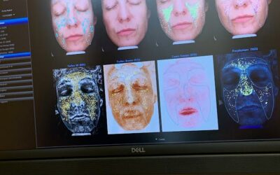 J’ai testé l’analyse VISIA : la vérité sur ma peau… et pourquoi vous devriez vraiment le faire