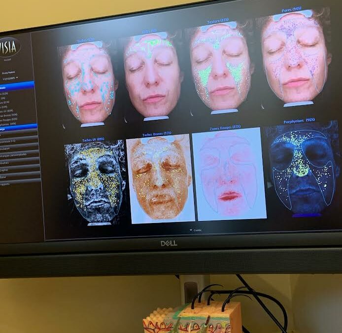 J’ai testé l’analyse VISIA : la vérité sur ma peau… et pourquoi vous devriez vraiment le faire